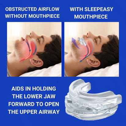 Silent Sleep Mouth Guard Anti Snoring
