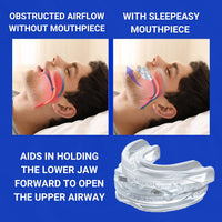 Silent Sleep Mouth Guard Anti Snoring