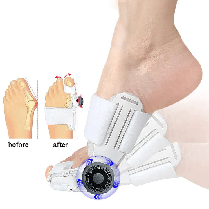 HappyToes Bunion Relief Straps